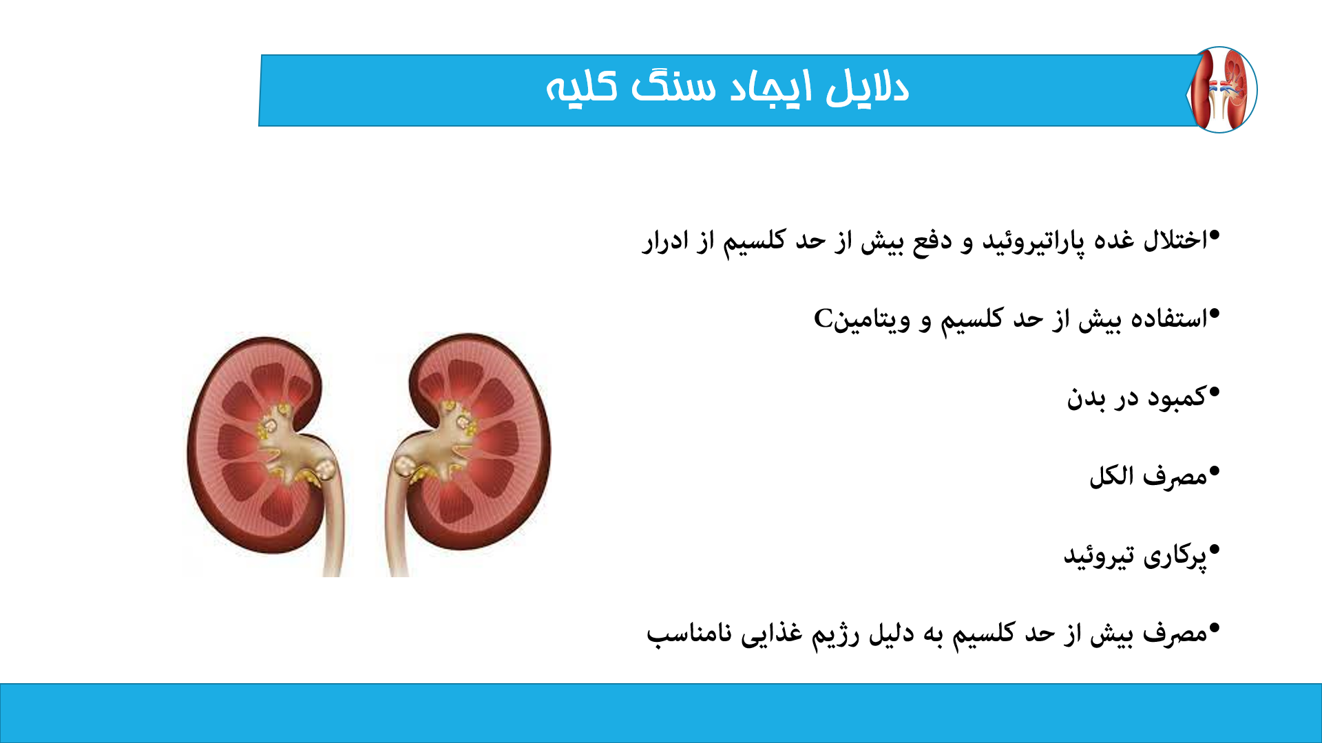 پاورپوینت سنگ کلیه و راه های درمان آن 